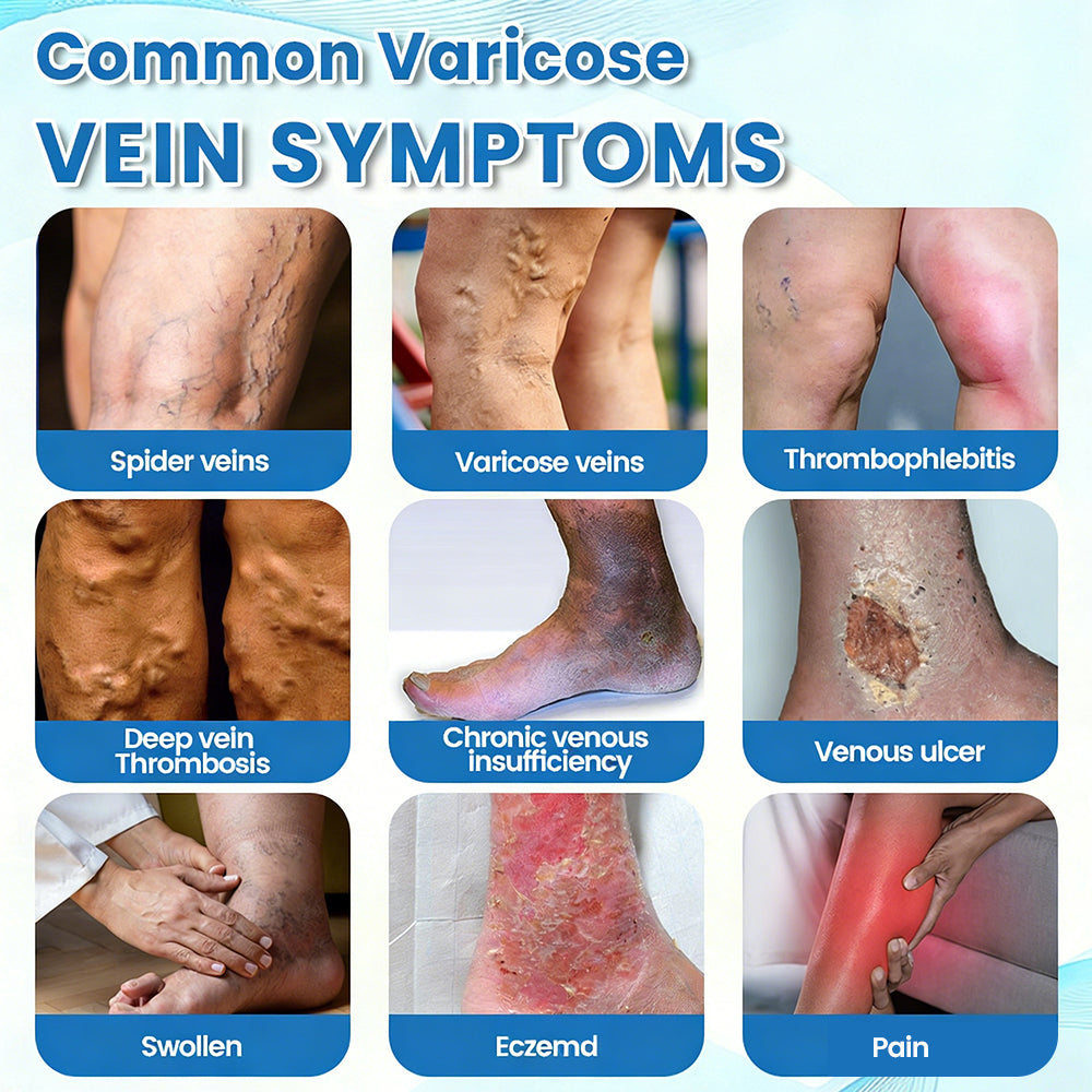 🇦🇺✅✅GFOUK® VascuCare Vein Healing Spray(Designed for Varicose veins, Spider veins, Deep vein Thrombosis, Chronic venous insufficiency, Venous ulcers, Thrombophlebitis and other venous issues)