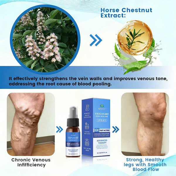 🇦🇺✅✅GFOUK® VascuCare Vein Healing Spray(Designed for Varicose veins, Spider veins, Deep vein Thrombosis, Chronic venous insufficiency, Venous ulcers, Thrombophlebitis and other venous issues)