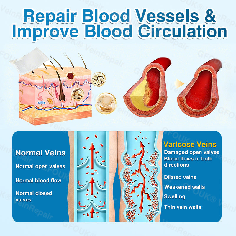 🇬🇧🥇👨‍⚕️⭐GFOUK® VeinRepair Microneedle Patch Roll⚡Instant Relief, Long-Term Results