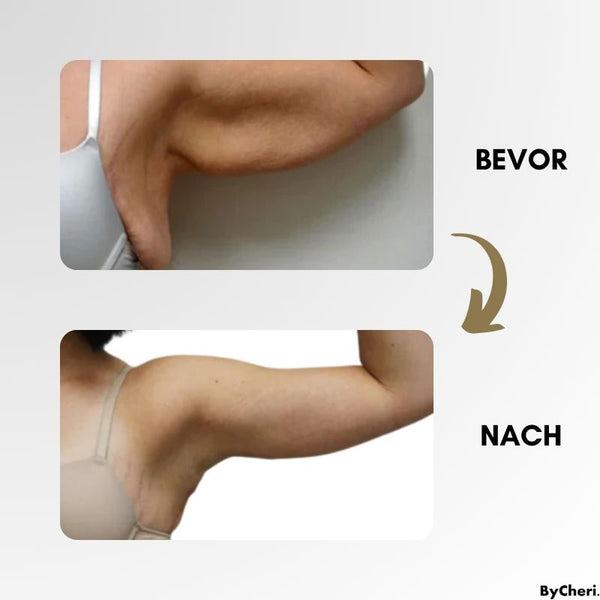 LymphWave™ Pack Stubborn Fat With Lymphatic Stimulation