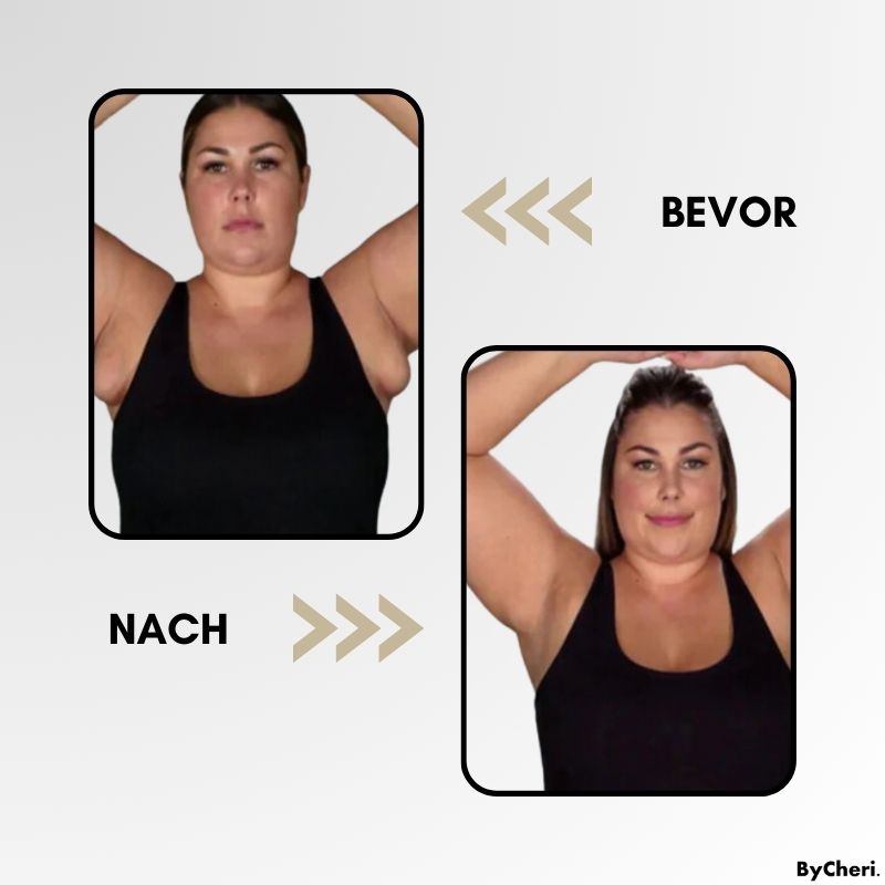 LymphWave™ Pack Stubborn Fat With Lymphatic Stimulation
