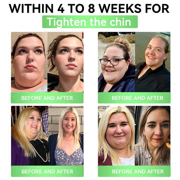 Moringa × Berberine × AMPK 8-Benefit Slimming & Metabolic Nano Microneedle Patch | Daily support for metabolism and heart health