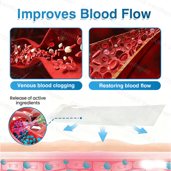 🇬🇧🥇👨‍⚕️⭐GFOUK® VeinRepair Microneedle Patch Roll⚡Instant Relief, Long-Term Results