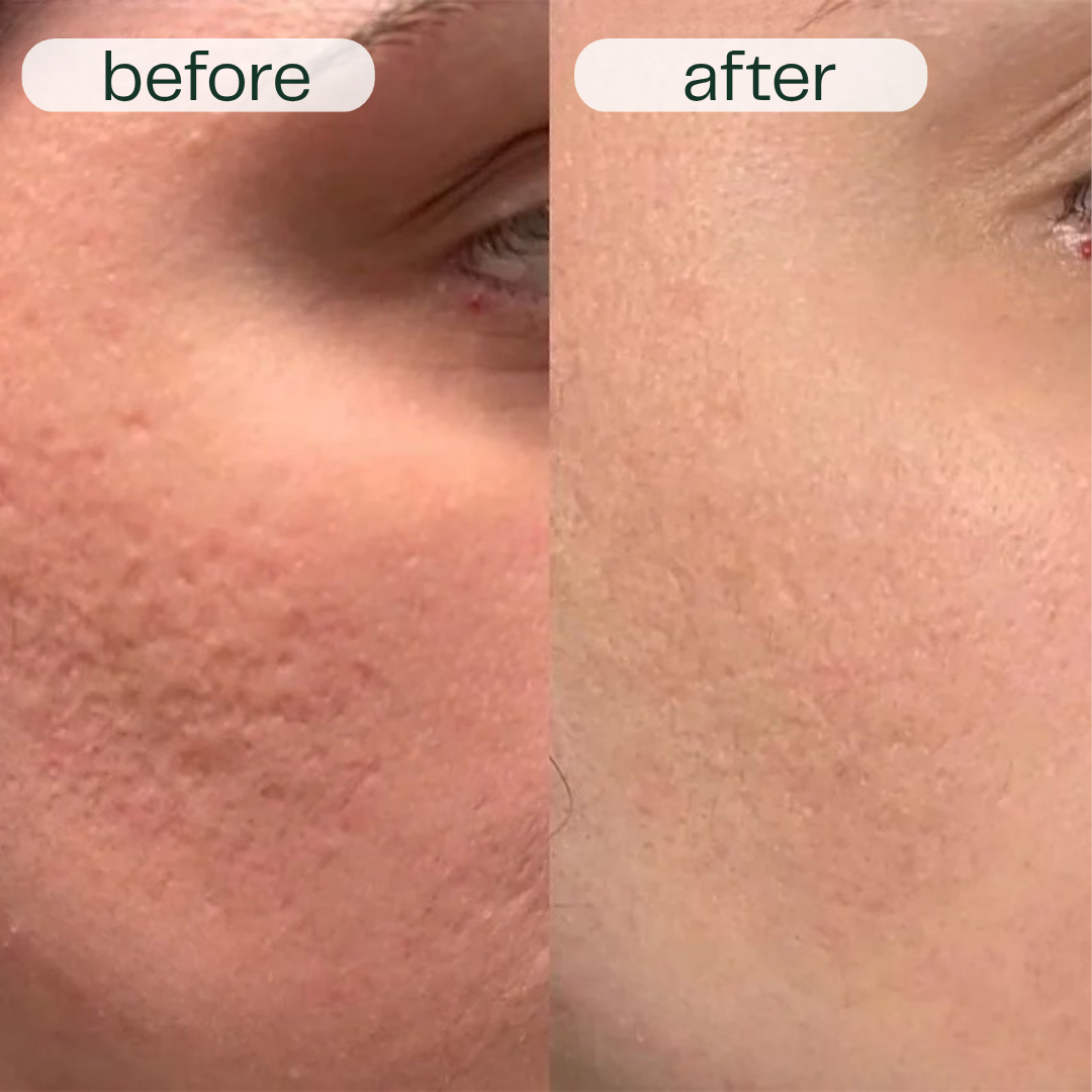 GlowNexa™ – Intensive Night Care Serum Duo for Smooth & Nourished Skin