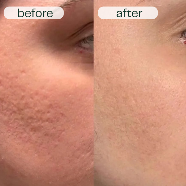 GlowNexa™ – Intensive Night Care Serum Duo for Smooth & Nourished Skin