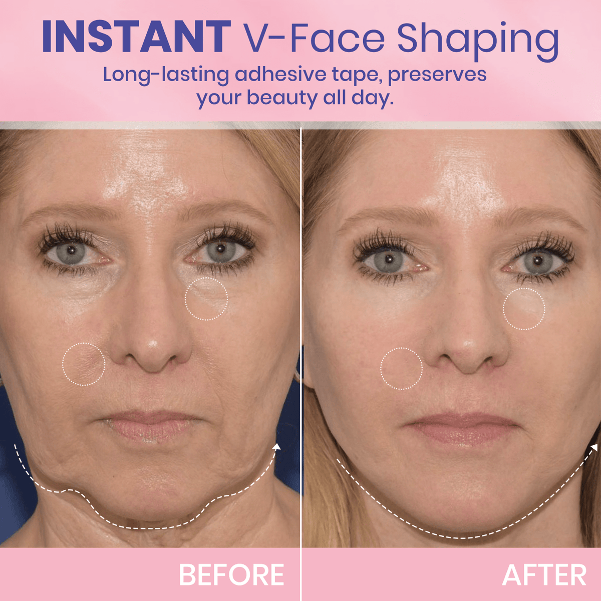 V Face-Lifting Invisible Tape