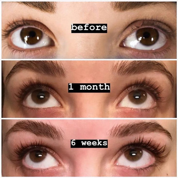 Eyelash Growth Serum