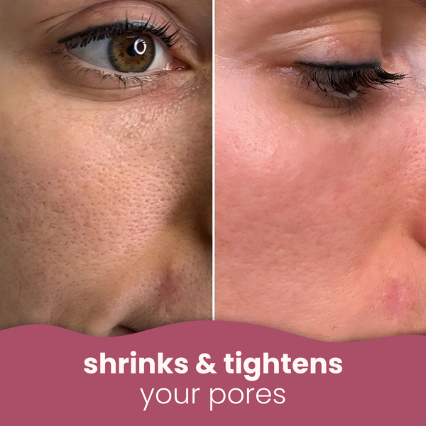 Brightening Turmeric & Kojic acid pads