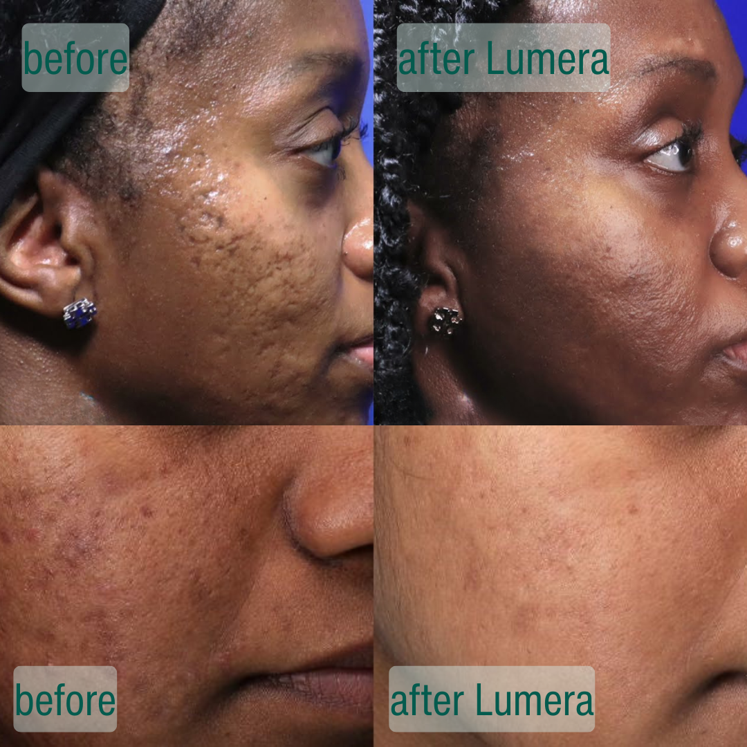 SkinCrystal™ Serum Duo Supports Smooth Radiant Skin