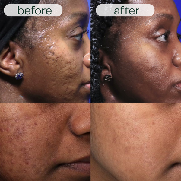 GlowNexa™ – Intensive Night Care Serum Duo for Smooth & Nourished Skin