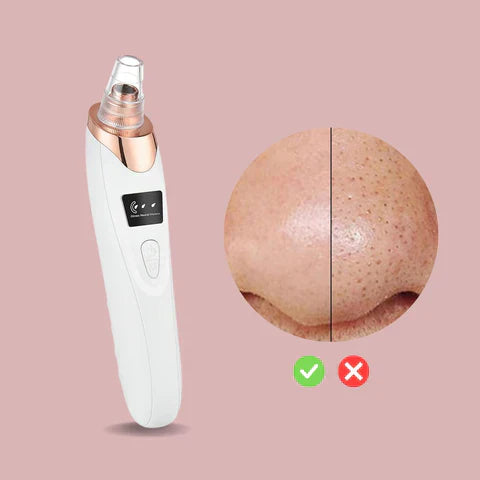 SkinClear™ – Endlich reine, makellose Haut ohne Pickelchen, frisch und strahlend [50% Rabatt]