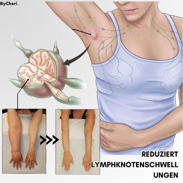 LymphWave™ Pack Stubborn Fat With Lymphatic Stimulation