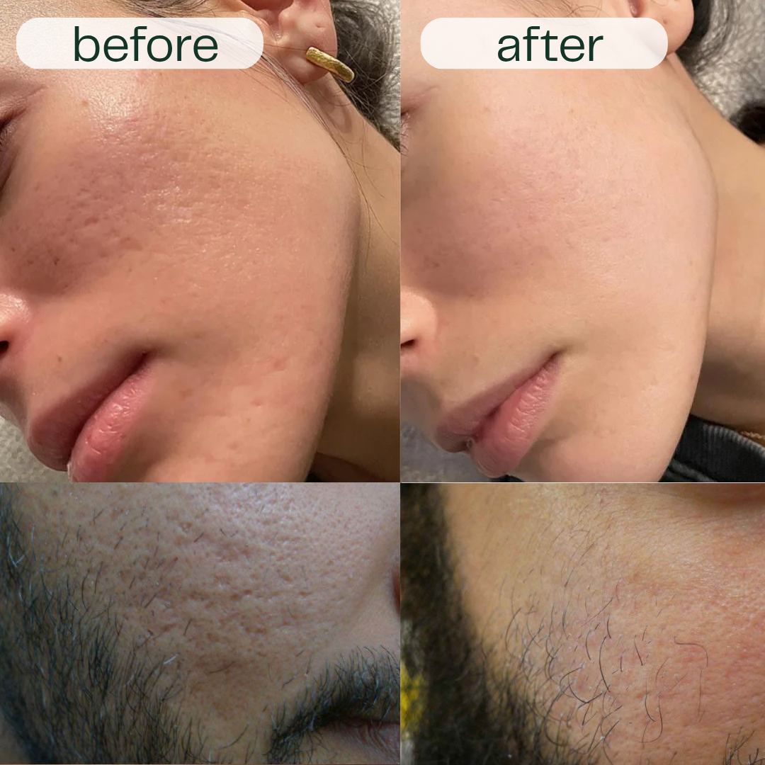 GlowNexa™ – Intensive Night Care Serum Duo for Smooth & Nourished Skin