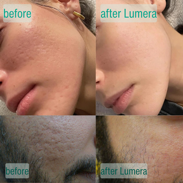 SkinCrystal™ Serum Duo Supports Smooth Radiant Skin