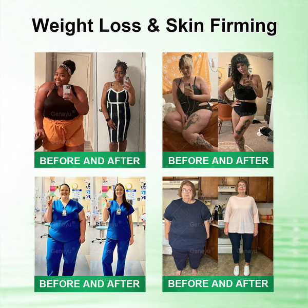 Slimming & Metabolic Nano Microneedle Patch -Visible changes in 7 days!