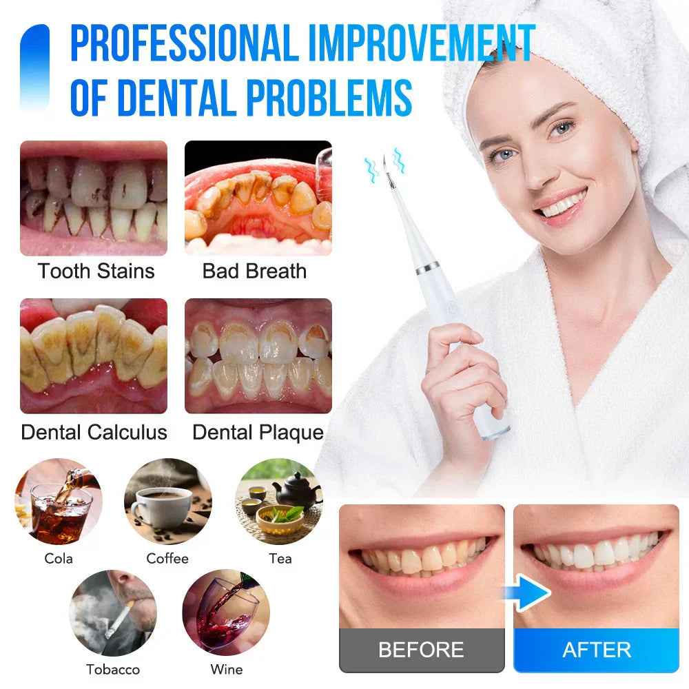 SONIC TOOTHBRUSHES™ – Professional-Grade Cleaning at Home