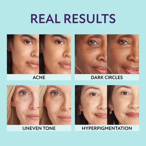 Glowpreme™ – Hochwirksamer Creme-Hautperfektionierer sofort sichtbar perfektionierend [50% Rabatt]