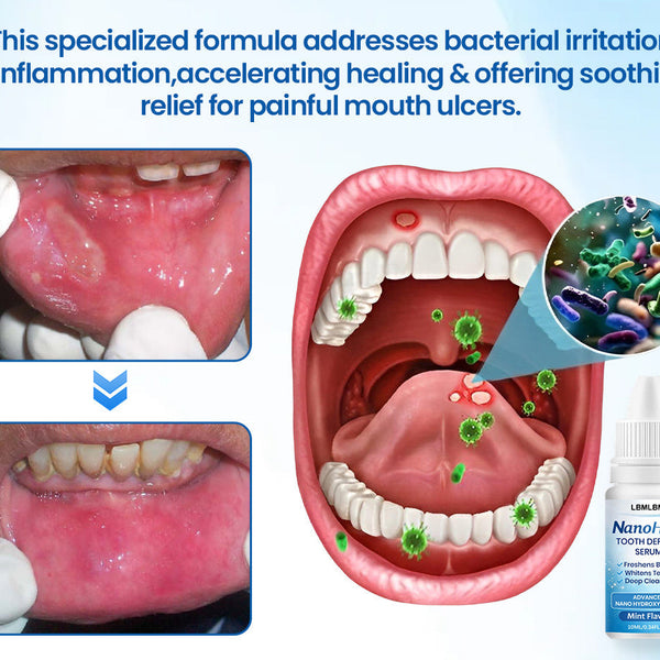 🦷 LBMLBM™ NanoHAP Zahnschutzserum
