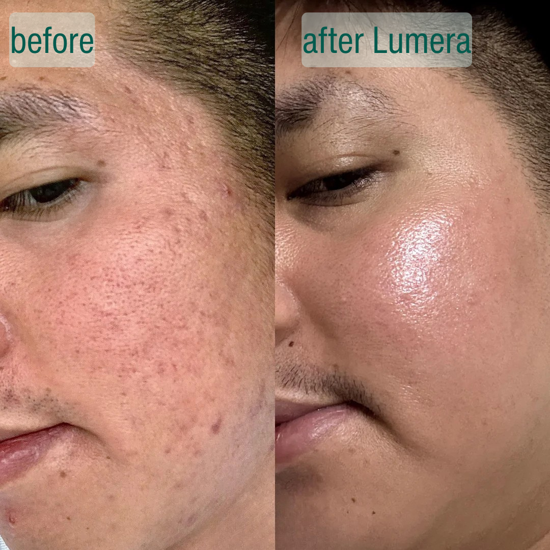 SkinCrystal™ Serum Duo Supports Smooth Radiant Skin