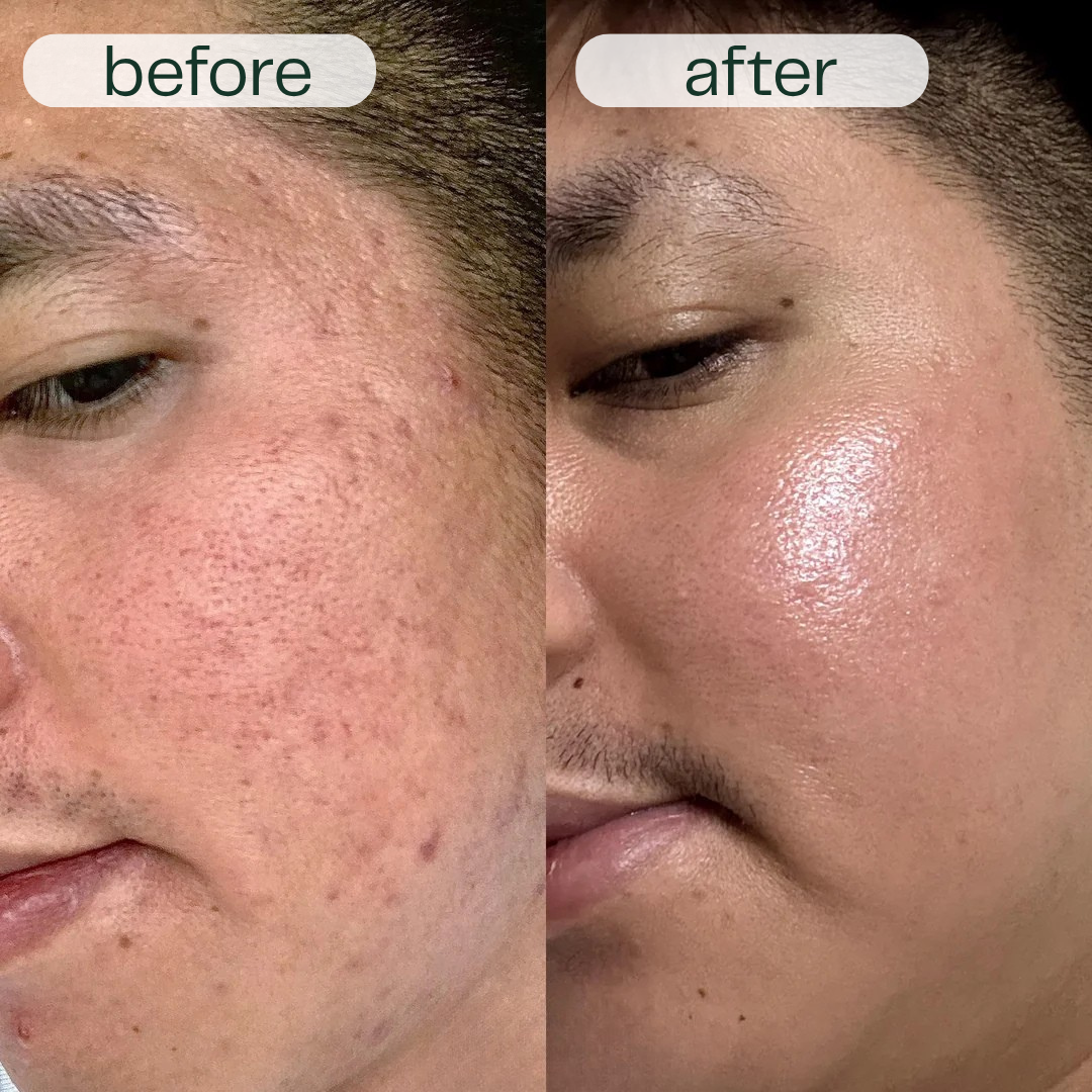 GlowNexa™ – Intensive Night Care Serum Duo for Smooth & Nourished Skin