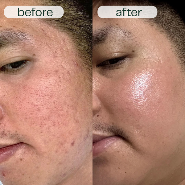 GlowNexa™ – Intensive Night Care Serum Duo for Smooth & Nourished Skin