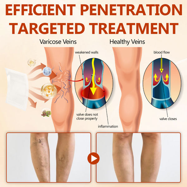 VeinRepair Microneedle Patch Roll