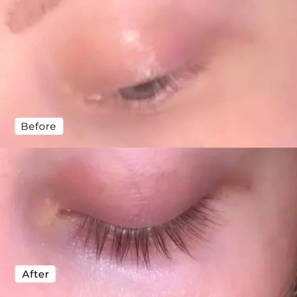 BIOAQUA Eyelash Blossom™ – Naturally Longer, Fuller Lashes in Just 7 Days
