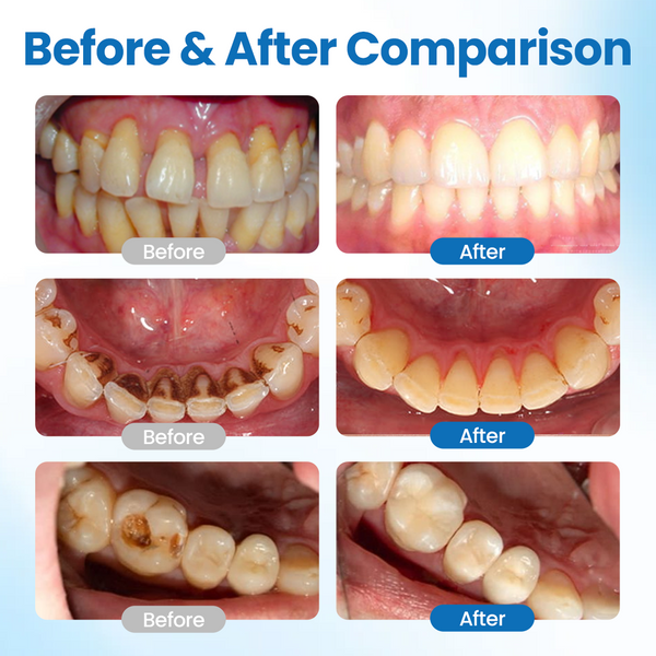🦷 LBMLBM™ NanoHAP Zahnschutzserum