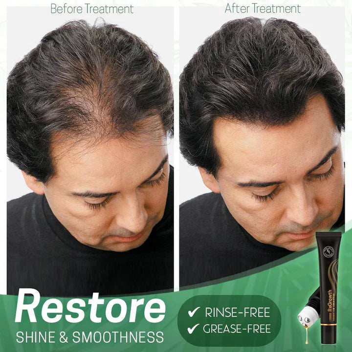 StrandSurge Serum — Ignite Your Hair’s Fierce, Unstoppable Power and Shine