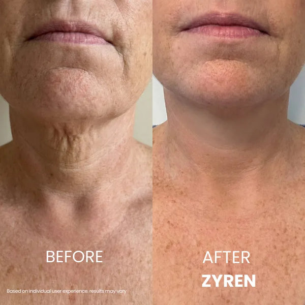 SkinSculpt™ Neck Firming Cream For Youthful Looking Beauty