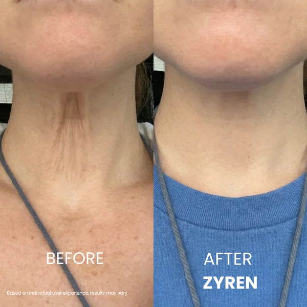 SkinSculpt™ Neck Firming Cream For Youthful Looking Beauty