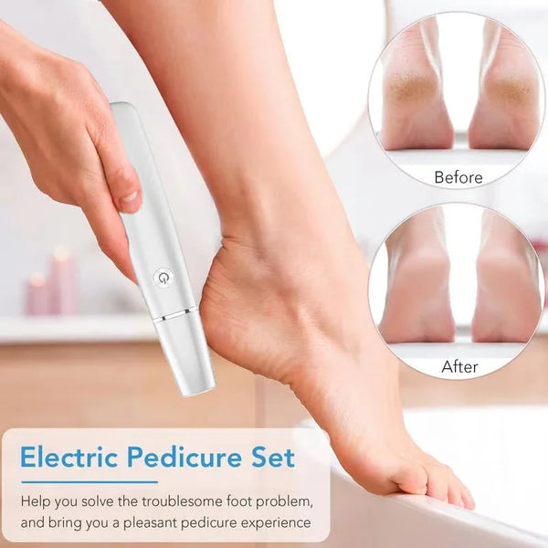 【LAST DAY SALE】Electric Foot Callus Remover