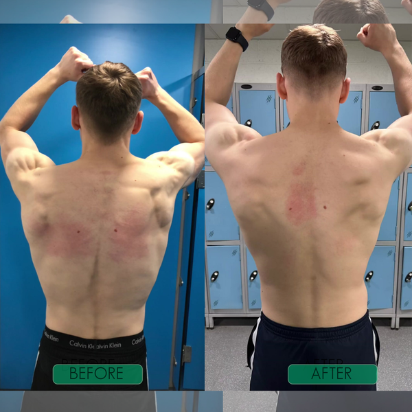 SpineEase™ Posture Corrector for Straighter Everyday Alignment