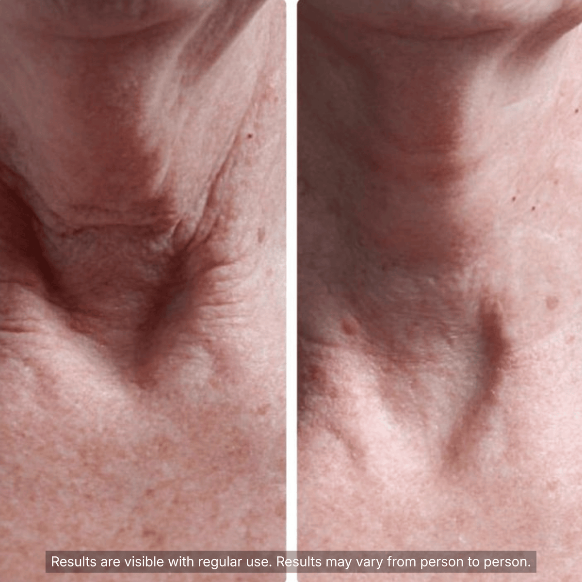 PDRN Collagen Volufiline Multi Balm