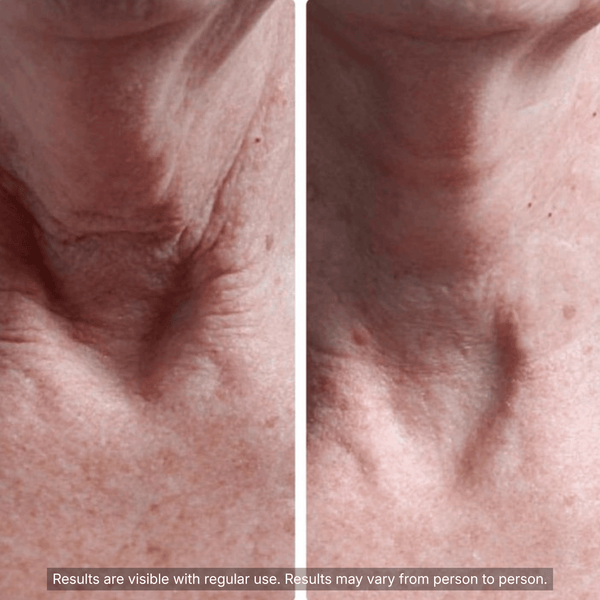 PDRN Collagen Volufiline Multi Balm