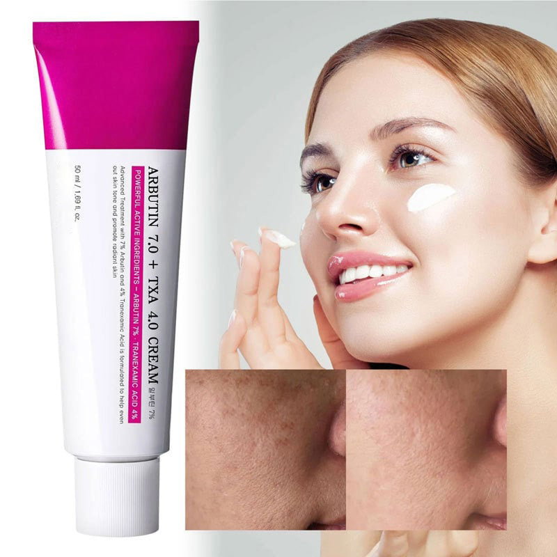 Elyzura™ – Creme gegen dunkle Flecken sanft, effektiv, aufhellend und sichtbar [1 + 1 Gratis]