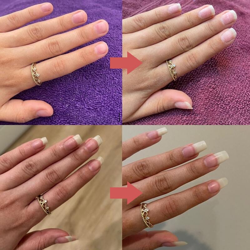 Seranail | Nail Nutrient-Rich Growth Oil