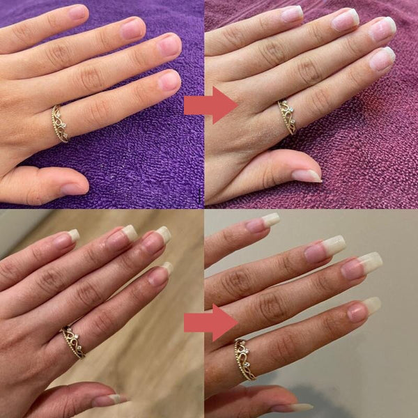 Seranail | Nail Nutrient-Rich Growth Oil