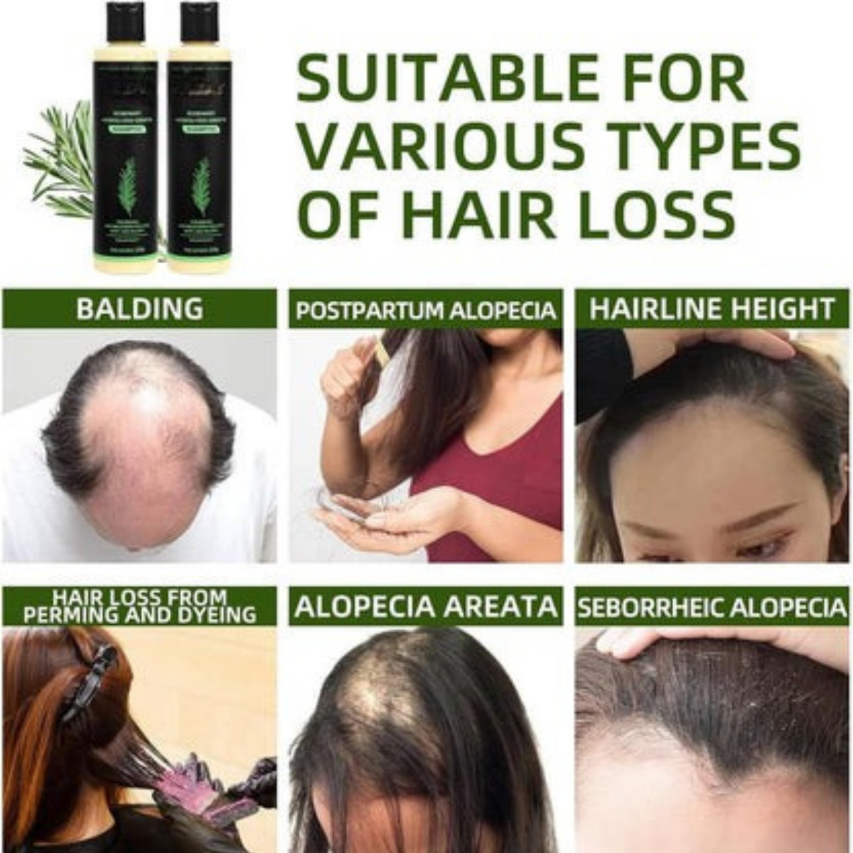 PureRose™ Rosemary Shampoo For Revitalized Healthy Looking Hair