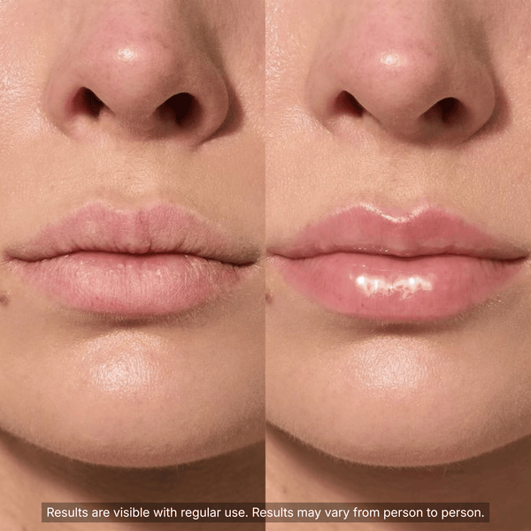 PDRN Collagen Volufiline Multi Balm