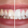 BrightWhiten™ | Color-Correcting Purple Toothpaste for a Dazzling Smile
