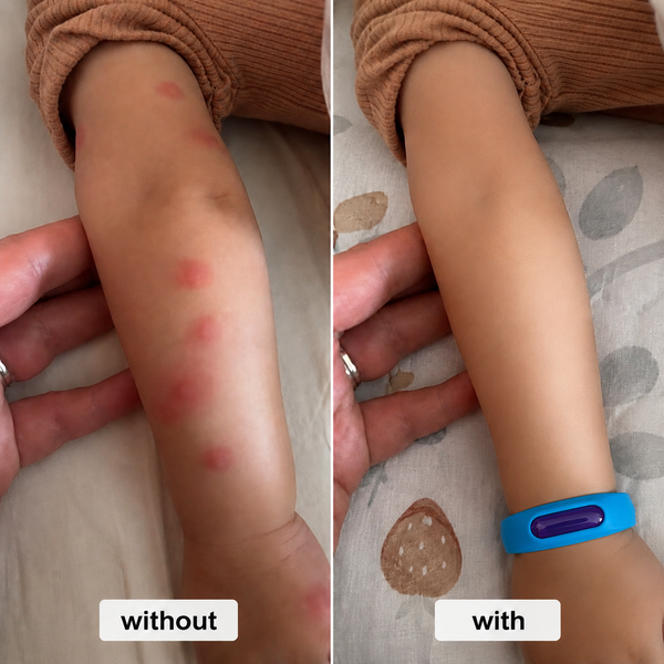 BiteFree™ Protection Bracelet Keeps Mosquitoes Away Naturally