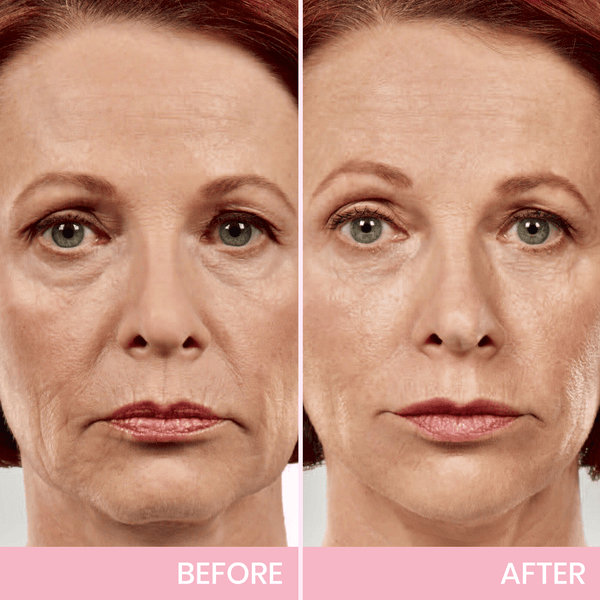 V Face-Lifting Invisible Tape