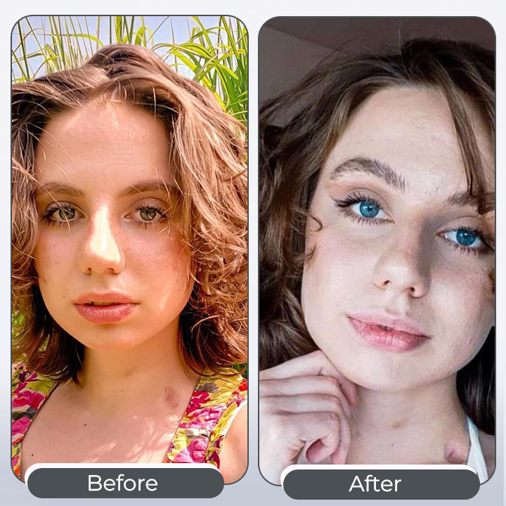 IriVance™ | Eye-Toning Color Drops