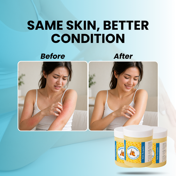 DermaFrost™ – Soothing Balm for Dry, Sensitive & Irritated Skin