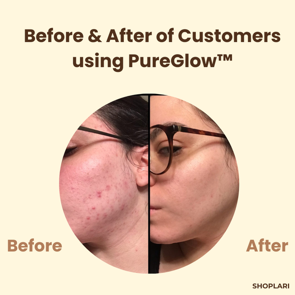 PureGlow™ – Tiefenreinigung der Poren, antioxidative Pflege, PureGlow Black Tea Maske [50% Rabatt]