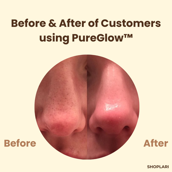 PureGlow™ – Tiefenreinigung der Poren, antioxidative Pflege, PureGlow Black Tea Maske [50% Rabatt]