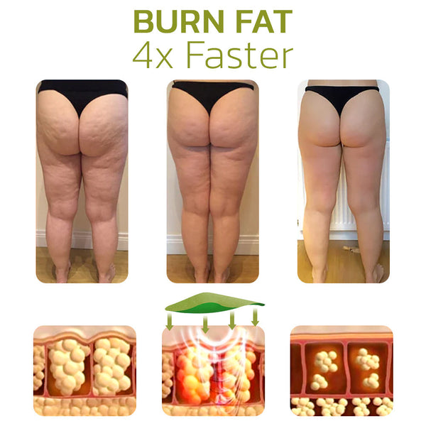 CelluClear™ Cellulite-Free Confidence