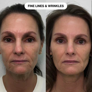 SkinBlur™ – Instant smoothing primer for an even finish