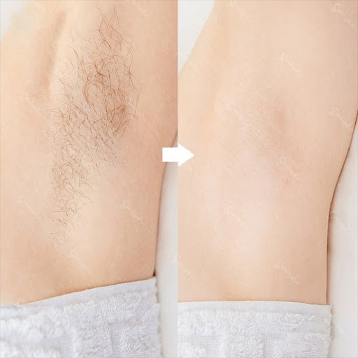 Hair Removal Oil